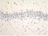 Fig. 11
