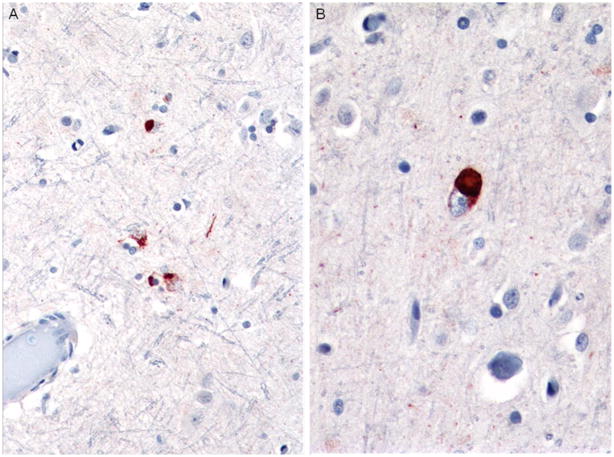 Fig. 14