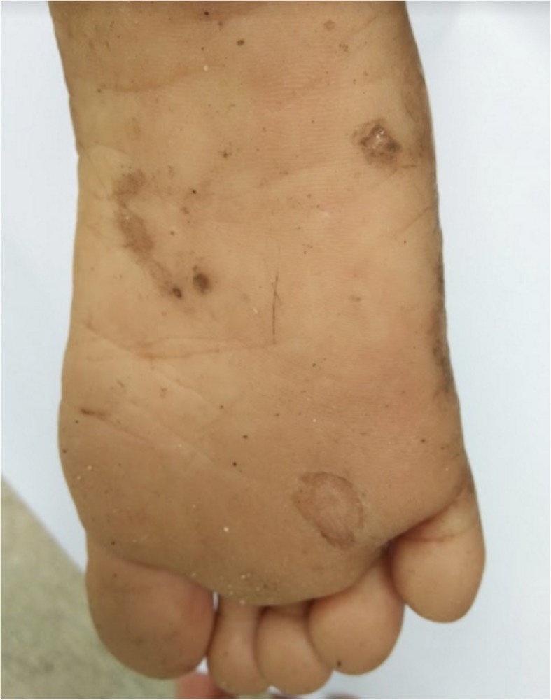 Fig. 11
