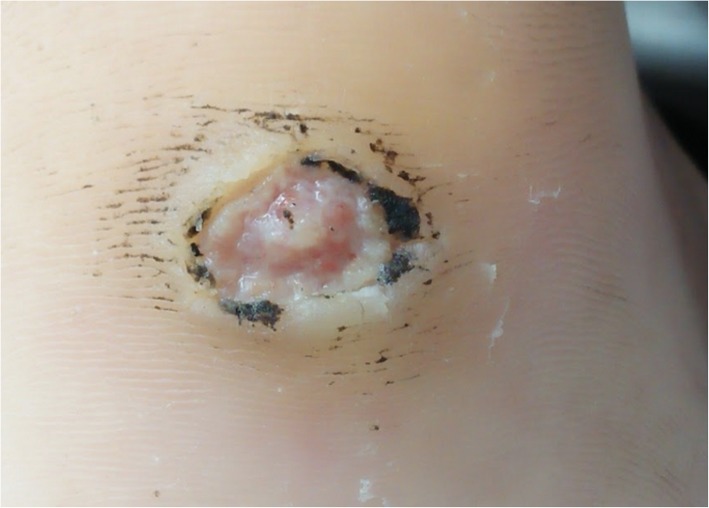 Fig. 12