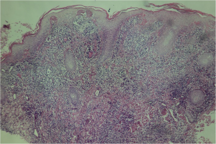 Fig. 5
