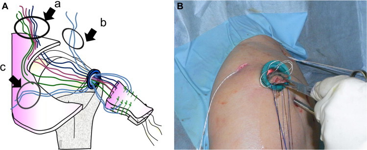 Fig 3