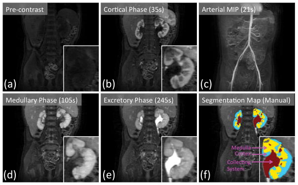 FIG. 6