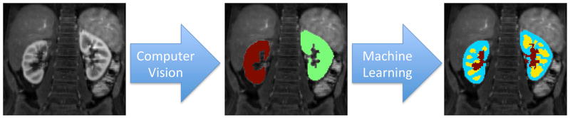 FIG. 1