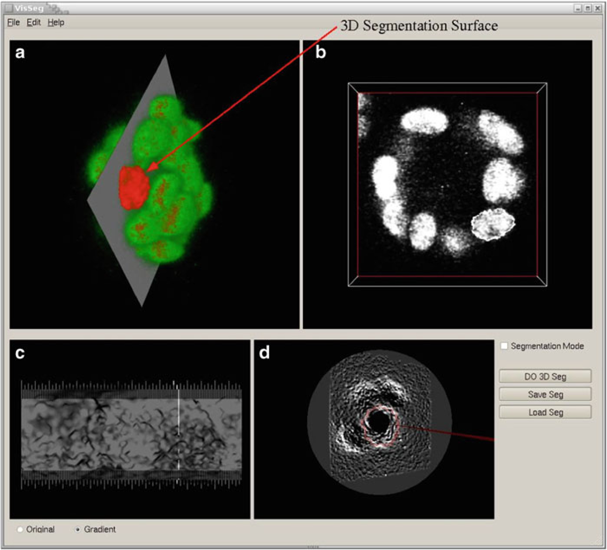 Fig. 10