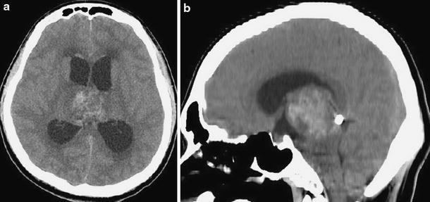 Fig. 1