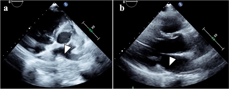 Fig. 4