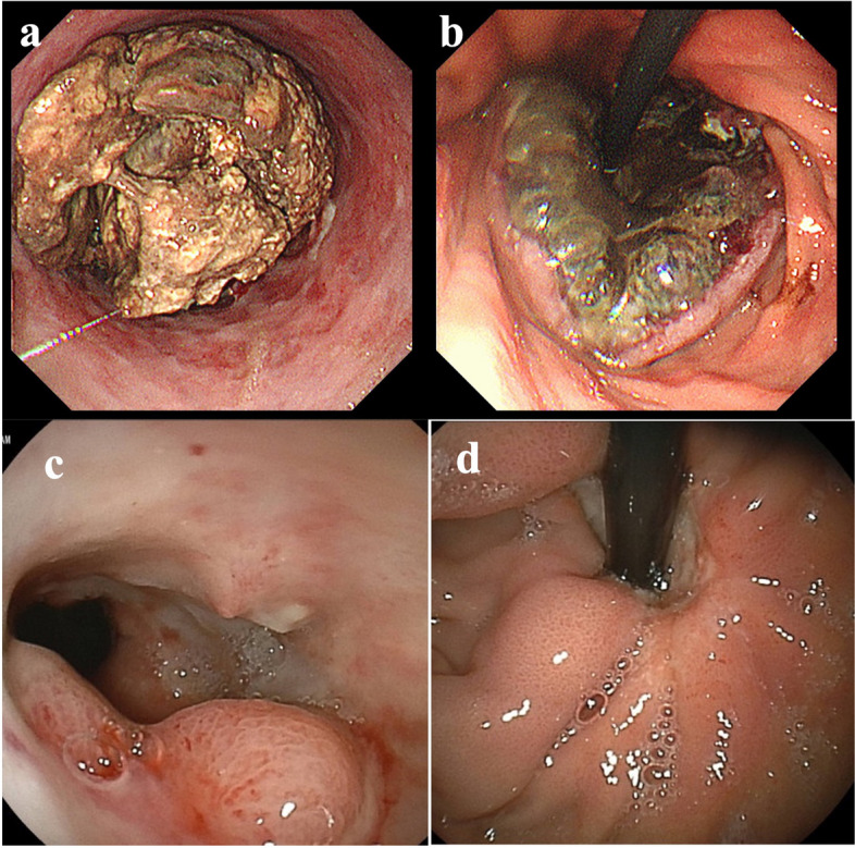 Fig. 1