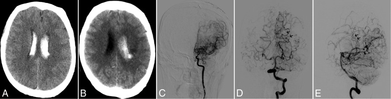 Fig 4.