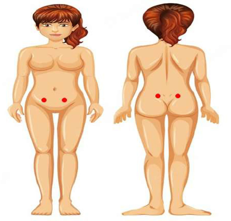 Fig 2