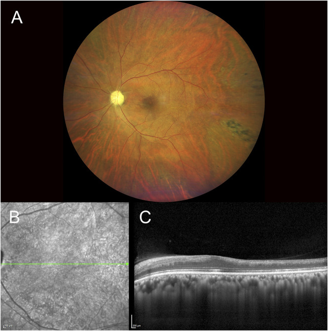 FIGURE 1