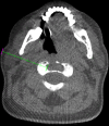 Fig 2: