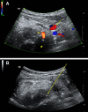 Fig 3: