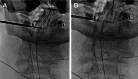 Fig 5: