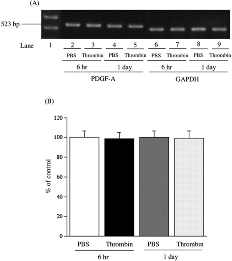 
Figure 11.
