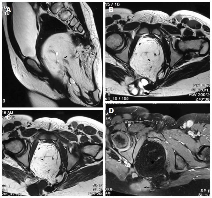 Figure 23