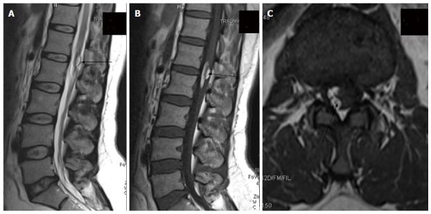 Figure 25