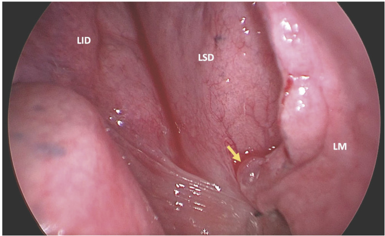 Figura 2