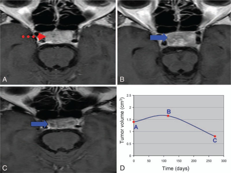 Figure 12