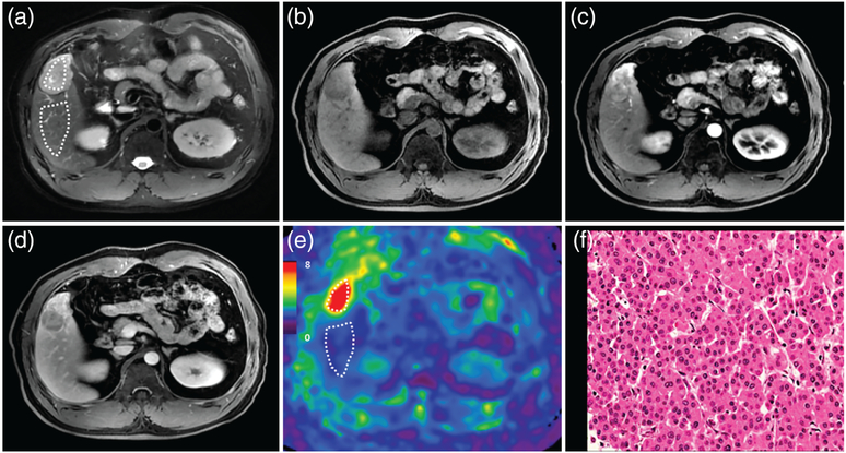 FIGURE 3: