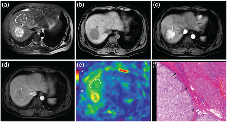 FIGURE 4: