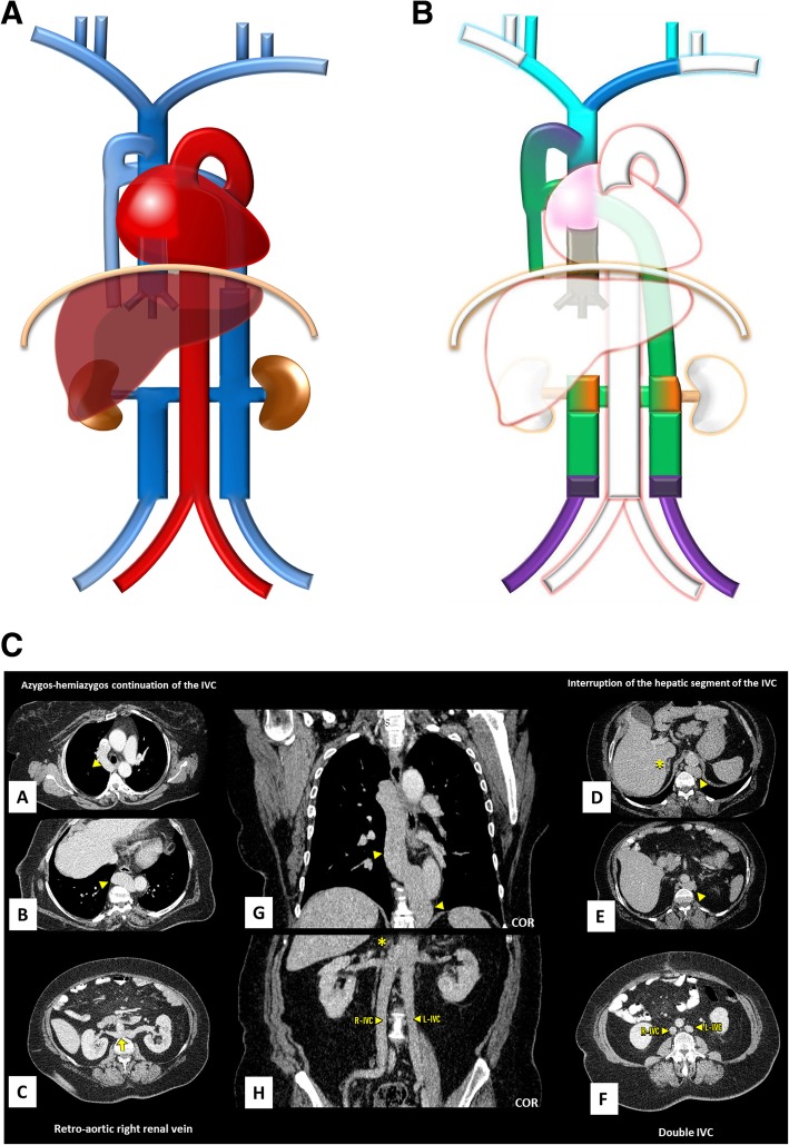 Fig. 13