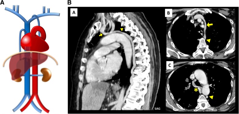 Fig. 17