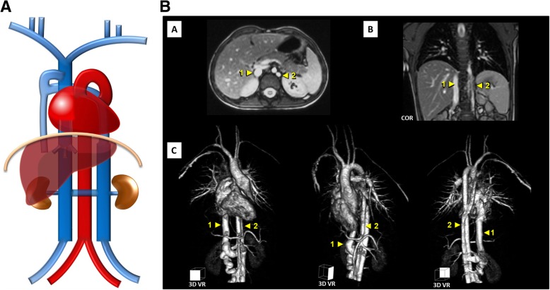 Fig. 15