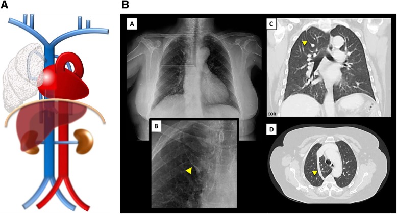 Fig. 14