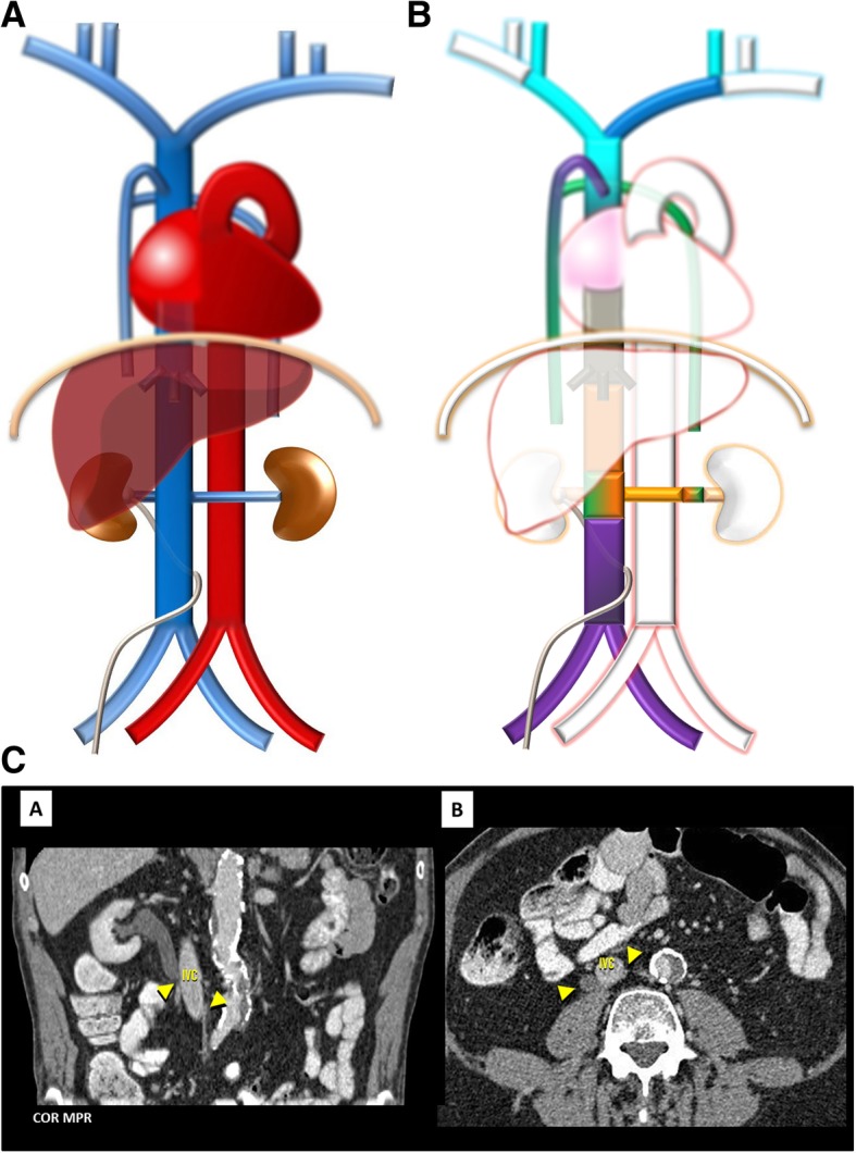 Fig. 12