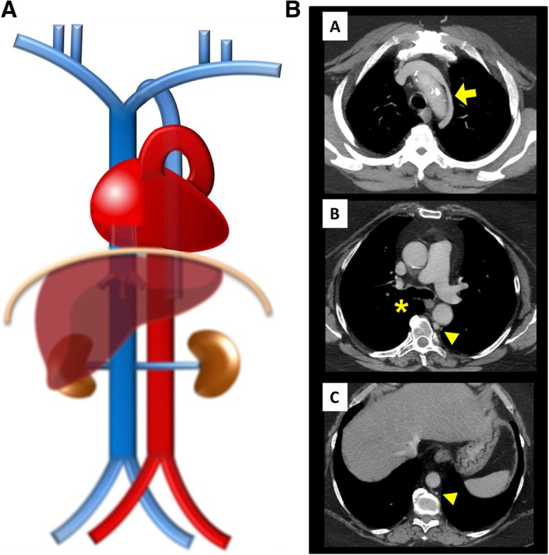 Fig. 16