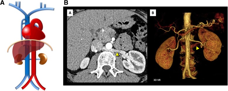 Fig. 11