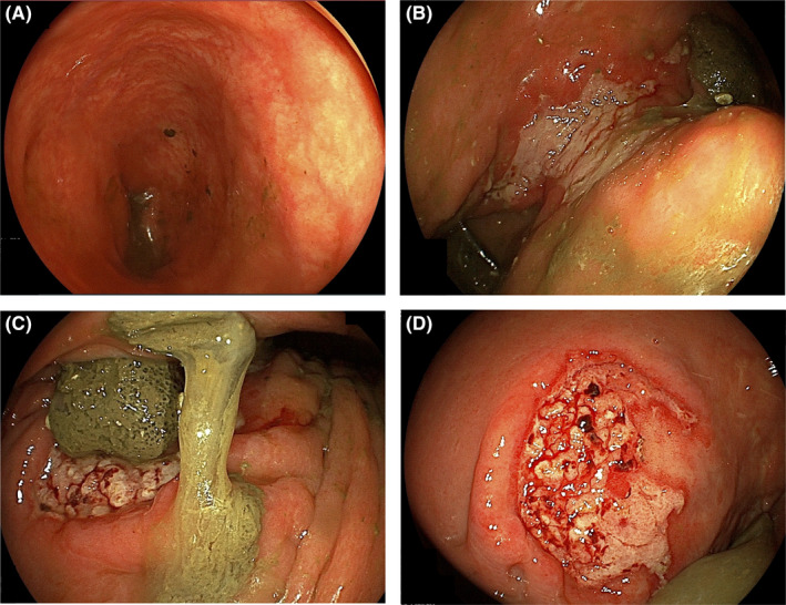 FIGURE 2