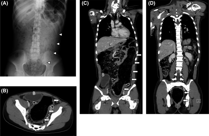 FIGURE 1