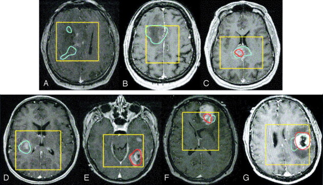 Fig 1.