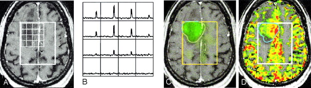 Fig 3.