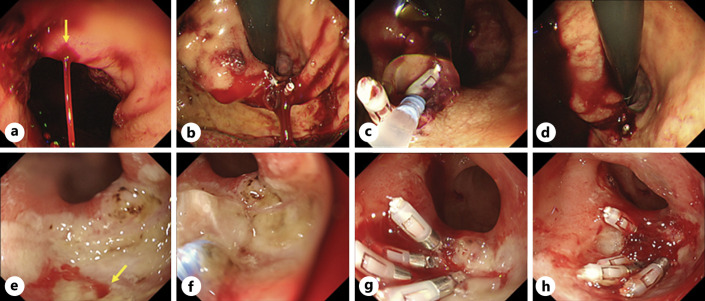 Fig. 2.