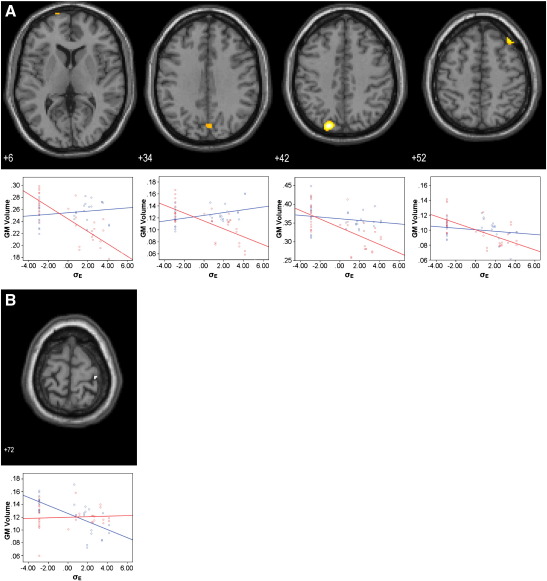 Fig. 4