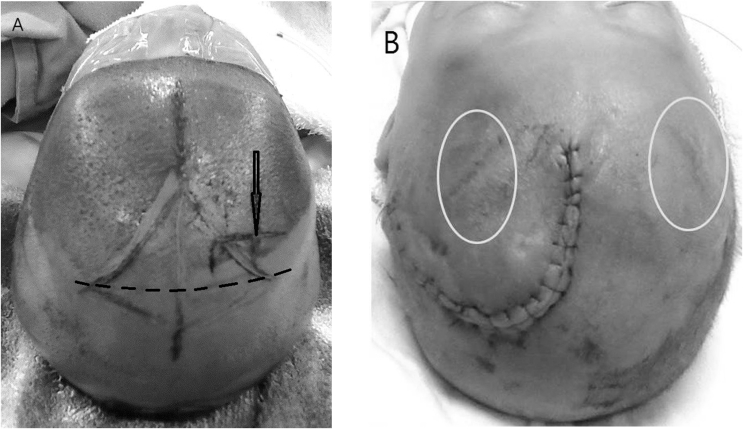 Fig. 1