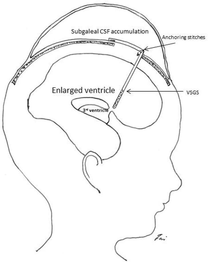 Fig. 2