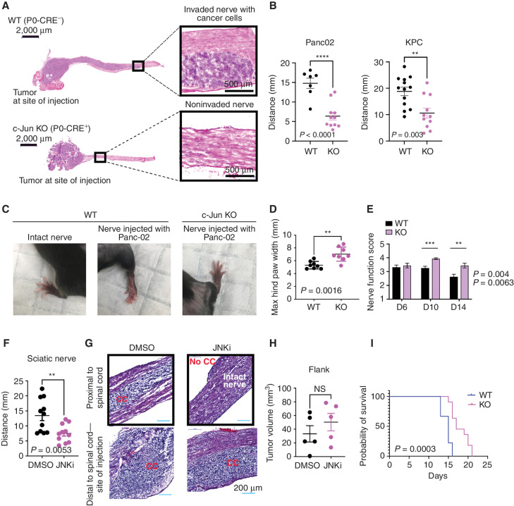 Figure 7. c-Jun–reprogrammed SCs promote cancer invasion in vivo. A, Histologic analysis of injected murine sciatic nerves in P0-CRE− (WT) and P0-CRE+ (c-Jun KO) c-Junfl/fl mice. Representative samples of cancer invasion detected by H&E staining. Boxes show the invasion of areas away from the site of injection. Scale bars, 2,000 μm. Box scale bars, 500 μm. B, Quantification of distance of nerve invasion by Panc02 cells (WT n = 7, c-Jun KO n = 11, mean ± SEM) and KPC cells (WT n = 13, c-Jun KO n = 11, mean ± SEM). C, Representative images of murine hind limbs after Panc02 cancer cell injections show less paralysis in c-Jun KO SC mice. D, Quantification of the maximum width of hind limb paw in P0-CRE− (WT) versus P0-CRE+ (c-Jun KO) c-Junfl/fl mice 10 days after cancer injection (n = 8 mice/condition, mean ± SEM). E, Quantification of sciatic nerve function in P0-CRE− (WT) versus P0-CRE+ (c-Jun KO) c-Junfl/fl mice (n = 8 mice/condition, mean ± SEM). F, Effect of SP600125 on sciatic nerve invasion. Quantification of the length of nerve invasion in mice injected with Panc02 and SP600125 [JNK inhibitor (JNKi)] or Panc02 and DMSO (n = 11 mice/treatment, mean ± SEM). G, Representative H&E staining images of sciatic nerves injected with Panc02 and SP600125 versus Panc02 and DMSO. Top images are from proximal nerve regions at the spinal cord. No cancer is seen within the SP600125-injected nerve. Bottom images are from the site of injection, distal to the spinal cord. CC, cancer cells. Scale bars, 200 μm. H, Effect of SP600125 on flank tumor growth. Quantification of tumor volume in mice coinjected with Panc02 and SP600125 and with Panc02 and DMSO (n = 5 mice/treatment, mean ± SEM). NS, not significant. I, Survival analysis of WT and c-Jun KO mice injected with Panc02 in the sciatic nerve (WT n = 9, c-Jun KO = 11, P = 0.0003).