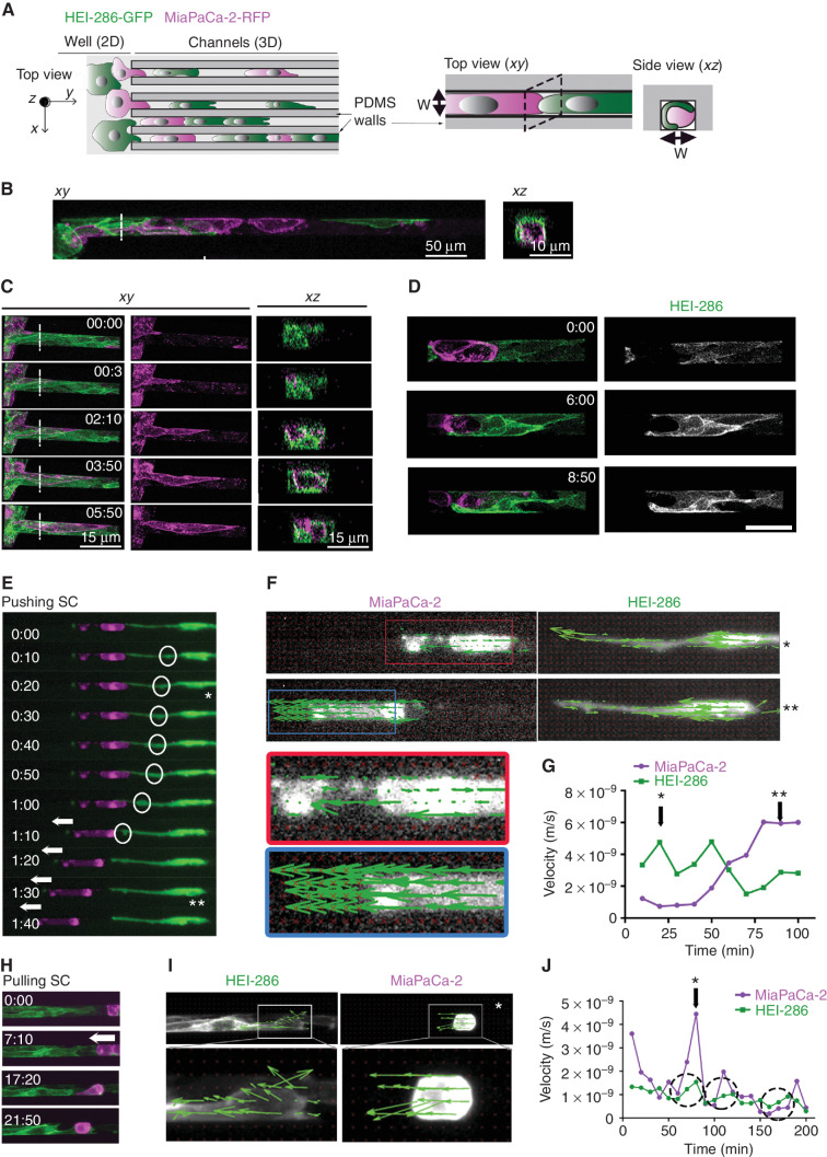 Figure 3. SCs form dynamic tracks for cancer cells. A, Schematic of microchannels with HEI-286 SCs (green) and MiaPaCa-2 cells (magenta). Both cell types are seeded in the adjacent well (left, 2D) and enter microchannels (3D) where they make contact with each other. PDMS, polydimethylsiloxane. B, Confocal images of HEI-286 SCs and MiaPaCa-2 within microchannels in longitudinal (xy) and transverse (xz) sections. Scale bars, 50 μm. C, Confocal images of time-lapse movies showing a cancer cell moving in a microchannel lined by HEI-286 SCs. Time is h:min. Scale bars, 15 μm. D, Confocal images of time-lapse movies showing an HEI-286 SC wrapping around a cancer cell. Scale bar, 50 μm. E, Fluorescent images of time-lapse movie showing an HEI-286 SC pushing a cancer cell. Arrows indicate cancer cell displacement. Circles indicate intracellular movement within the SC (* and ** are time points shown in E). F, Fluorescent images of an HEI-286 SC and cancer cell from E at two time points (* and **) overlaid with vectors obtained by PIV analysis indicating vector direction. G, Quantification of the mean instantaneous velocity of the HEI-286 SC and cancer cell in E, F, and G. Corresponding time points are indicated by * and **. H, Fluorescent images of time-lapse movie showing HEI-286 SCs pulling a cancer cell. Arrows indicate cancer cell displacement. I, Fluorescent images of the HEI-286 SCs and cancer cells from H at one time point (*) overlaid with vectors obtained by PIV analysis. J, Quantification of the mean instantaneous velocity. *, Corresponding time point in I. Dotted circles indicate periods with synchronized increases in velocity for both cancer cells and SCs.