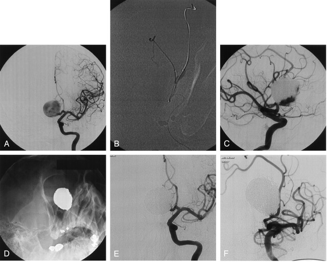 Fig 2.