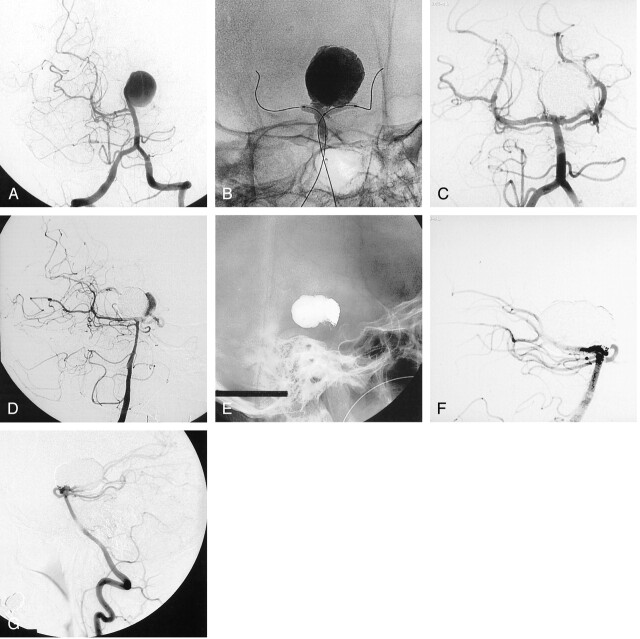 Fig 3.