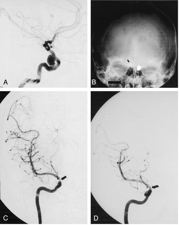 Fig 4.