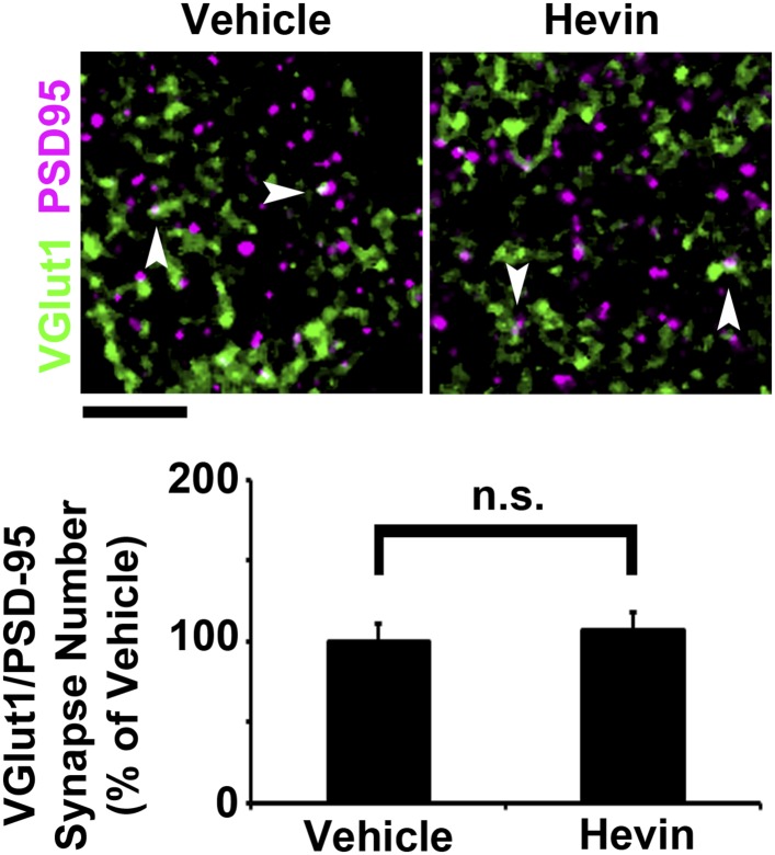 Figure 4—figure supplement 1.