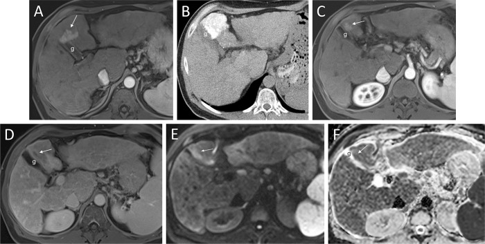 Fig. 7.