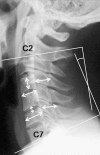 Fig. 1