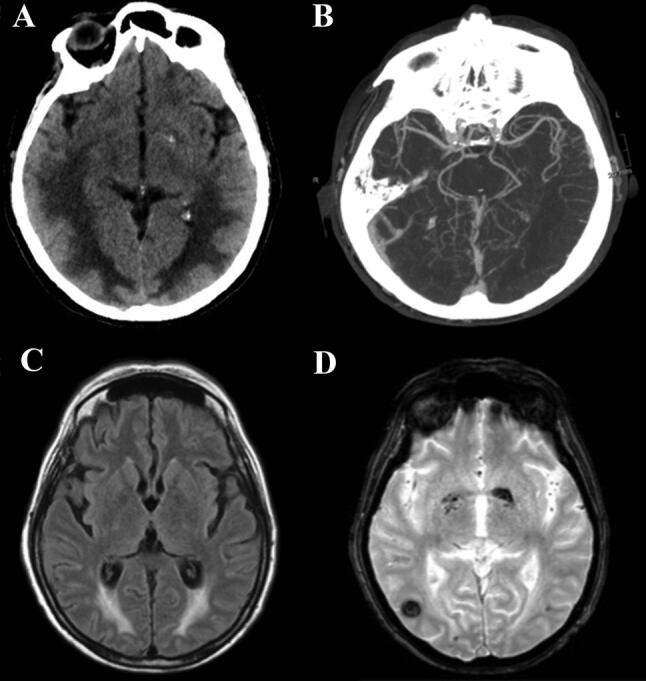 Fig.1