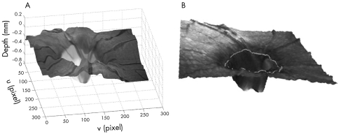 graphic file with name bj82313.f7.jpg